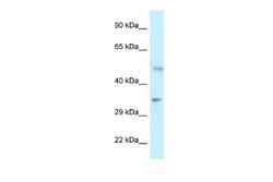 PFKFB1 Rabbit anti-Human, Polyclonal, Novus Biologicals 0.1 mL | Buy Online | Novus Biologicals | Fisher Scientific